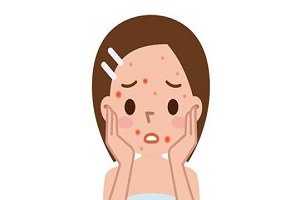 激光去痘印的方法有哪些