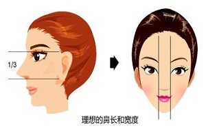 上海隆鼻手术分为哪几种方法