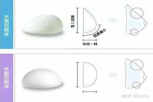 假体丰胸材料植入过量会有什么危害