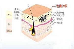 复合彩光嫩肤的效果表现有哪些呢