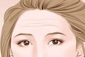 有效去除抬头纹的方法
