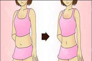 腰部吸脂是怎样进行的