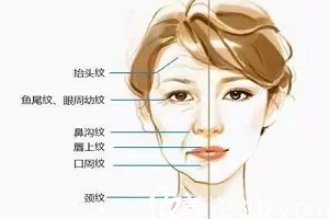 4种眼部除皱法打造靓丽明眸