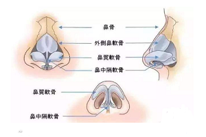 如何避免假体隆鼻手术的副作用