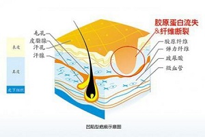 激光祛疤痕比手术切除法安全