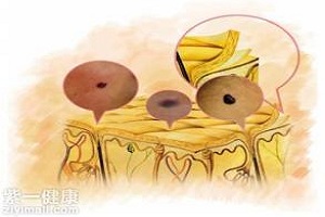 激光去痣的价格影响因素有哪些