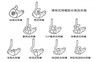 副耳切除会有副作用吗