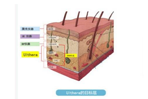 那些原因会影响电波拉皮效果