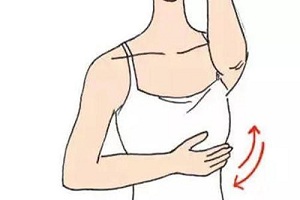 乳房下垂矫正术注意事项