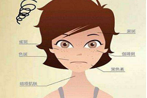 先天性的雀斑该如何去除效果好