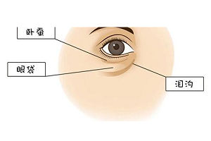 去眼袋手术的并发症都有哪些呢