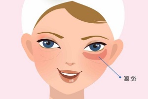 去眼袋手术的后遗症该如何避免呢